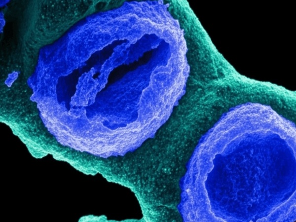 Core Value and Application Pote