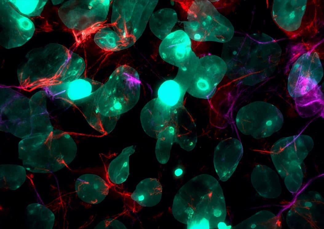 MDA-MB-231-Luc: CDK16-Mediated 