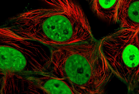 DU145-Luc: Enabling In Vivo Rat