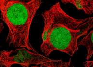 Raji-Luc: A CRISPR-Engineered P