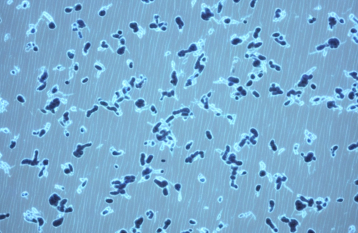 The MB49 Cell Model: A Powerful Tool for Elucidating Mechan