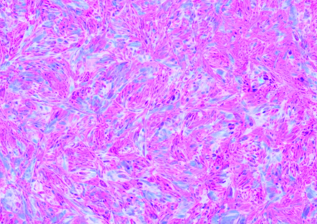 The DU4475 Cell Line: A Unique Suspension Model for Studyin