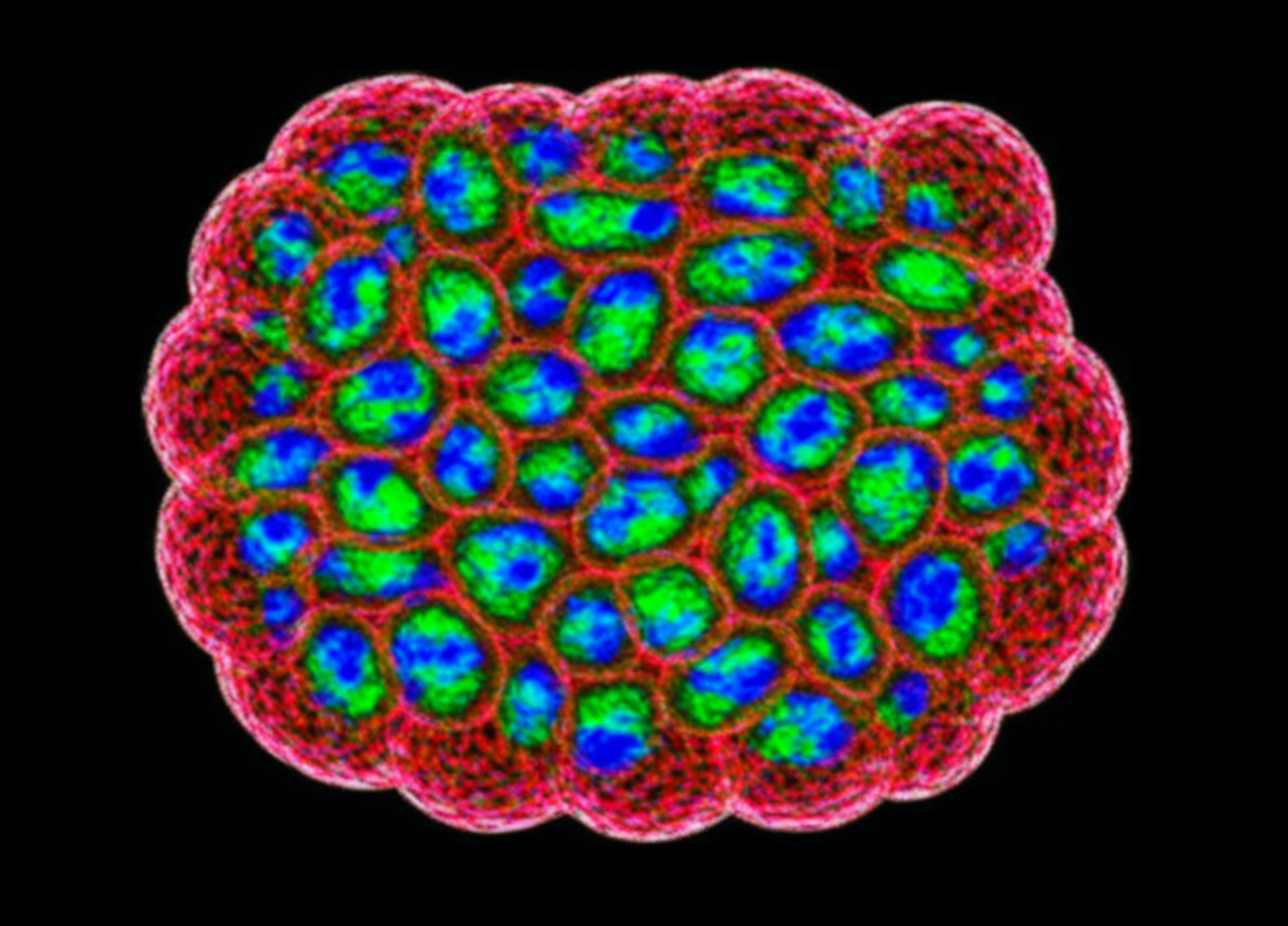 HER2+ Breast Cancer Model Showdown: BT-474 vs. SK-BR-3, How