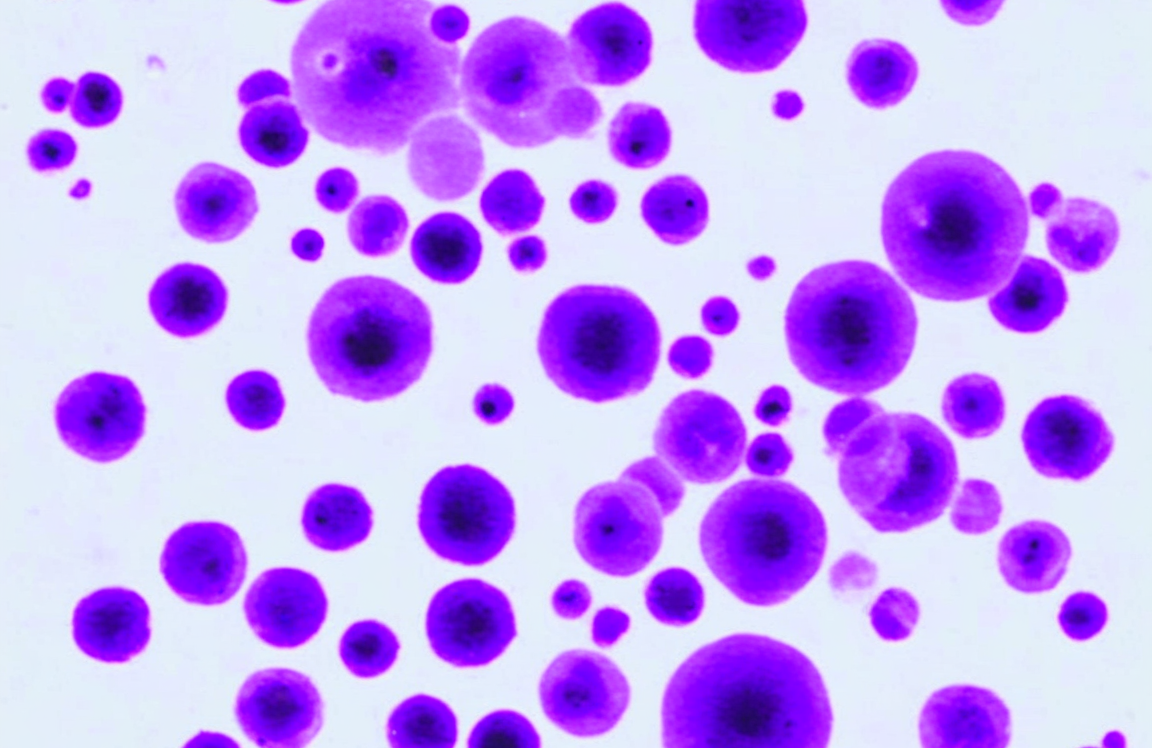The MV-4-11 Cell Line: A Core T