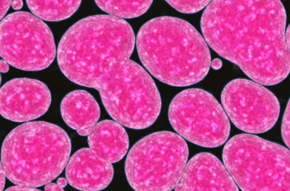 How to Select the Correct Model