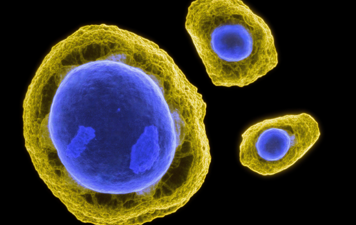 Visualizing Melanoma Metastasis