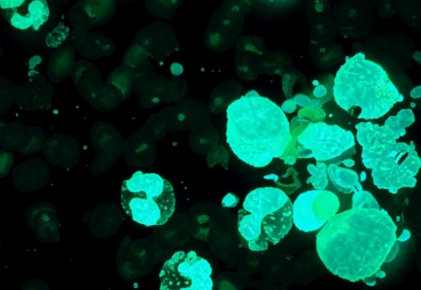 In Situ-generated Vaccine-like 