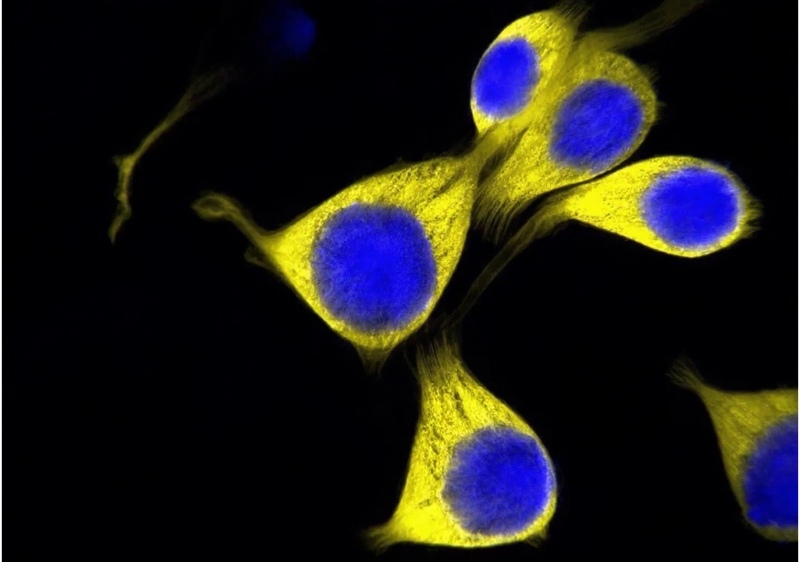 TCF1 Dependency in Tumor Immuno
