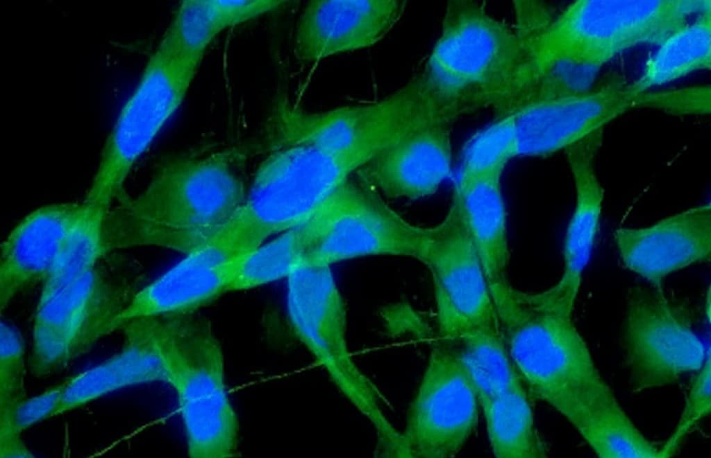 How Cysteine-Depleting 4T1 Tumor Models Revealed Synergisti