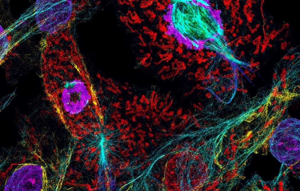 Mechanistic Insights into Tumor-Antigen-Specific T Cell Dep