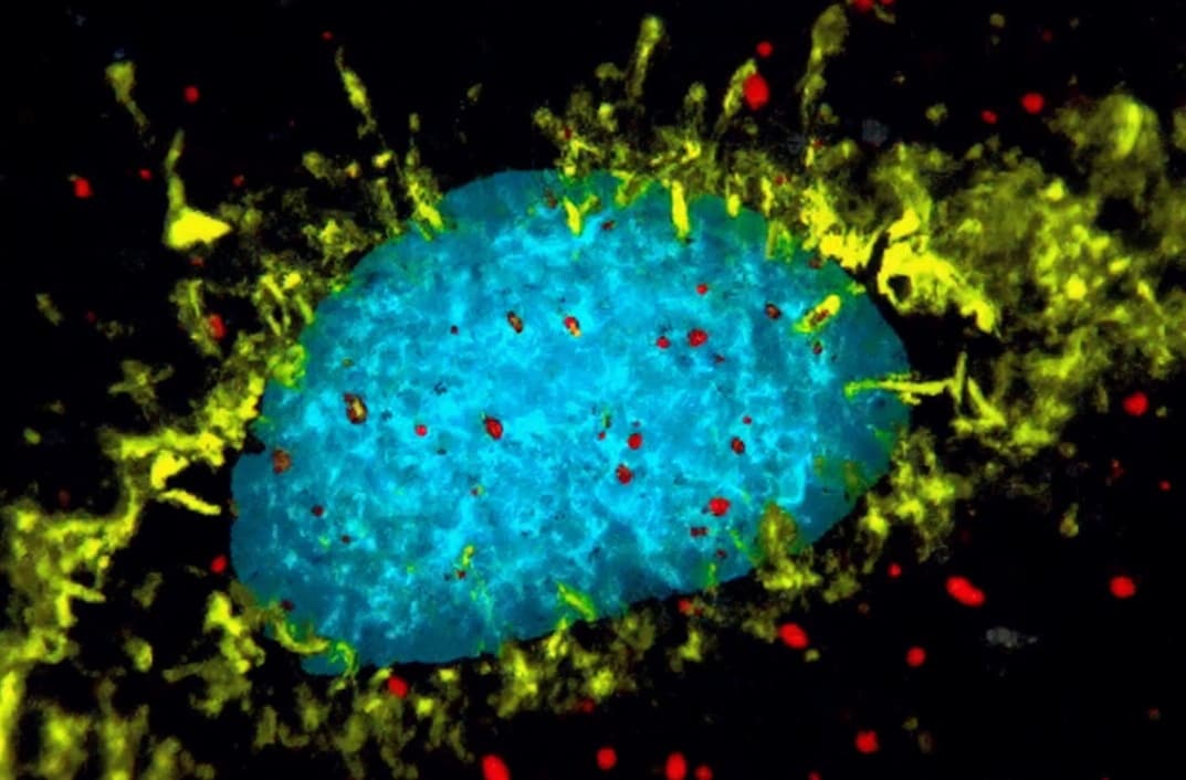 Engineering tLyp-1-Modified Exosomes to Silence oncogenic c