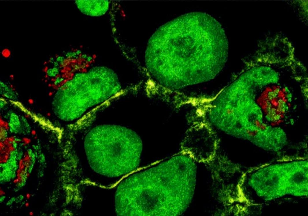 A549-luc: Illuminating How Chemotherapy-Induced Senescence 